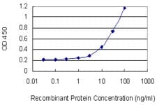 TXK / RLK Antibody (clone 2D8)