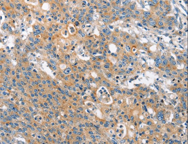 CHMP1A Antibody