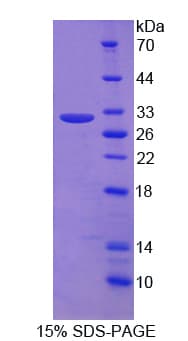 Human MYL6B Protein (Recombinant His)