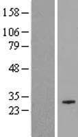 COX18 Protein (Over-Expression Lysate Myc-DDK (Flag))
