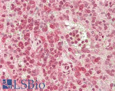 IHC-plus™ ANKRD52 Antibody