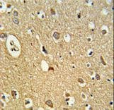 OMD / Osteomodulin Antibody (aa394-421)