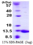 Mouse S100A5 Protein (Recombinant His)