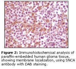 SNCA / Alpha-Synuclein Antibody (clone 2B2D1, 2B2A11)