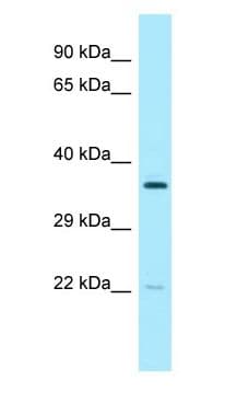 Polyclonal Rabbit anti-Human PCTP Antibody (aa70-119, WB)