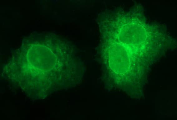 SCARB1 / SR-BI Antibody (clone OTI1E1)