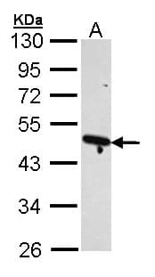 IHC-plus™ Polyclonal Rabbit anti-Human ACTR2 / ARP2 Antibody (IHC, WB)