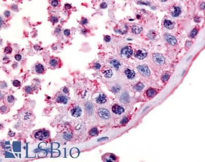 IHC-plus™ MC5R / MC5 Receptor Antibody (Extracellular Domain)