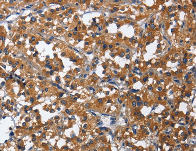 CD27 Antibody