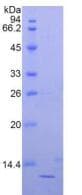 Human B2M / Beta 2 Microglobulin Protein (Recombinant His)