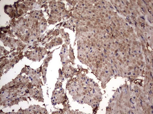 KRT7 / CK7 / Cytokeratin 7 Antibody (clone OTI2A2)