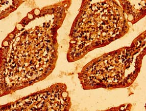 Polyclonal Rabbit anti-Human MCU / CCDC109A Antibody (IHC, WB)