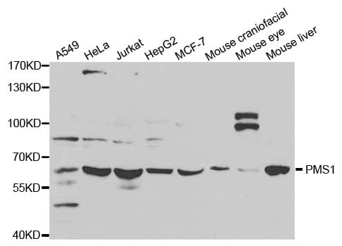 HPMS1 / PMS1 Antibody