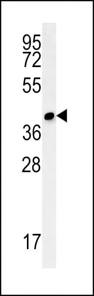 CCDC106 Antibody (aa151-180)