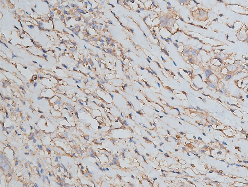 Polyclonal Rabbit anti-Human ANXA2 / Annexin A2 Antibody (IHC, WB)
