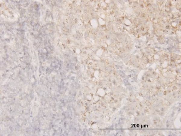 Monoclonal Mouse anti-Human CFL1 / Cofilin Antibody (clone 1A1, IHC, IF, WB)