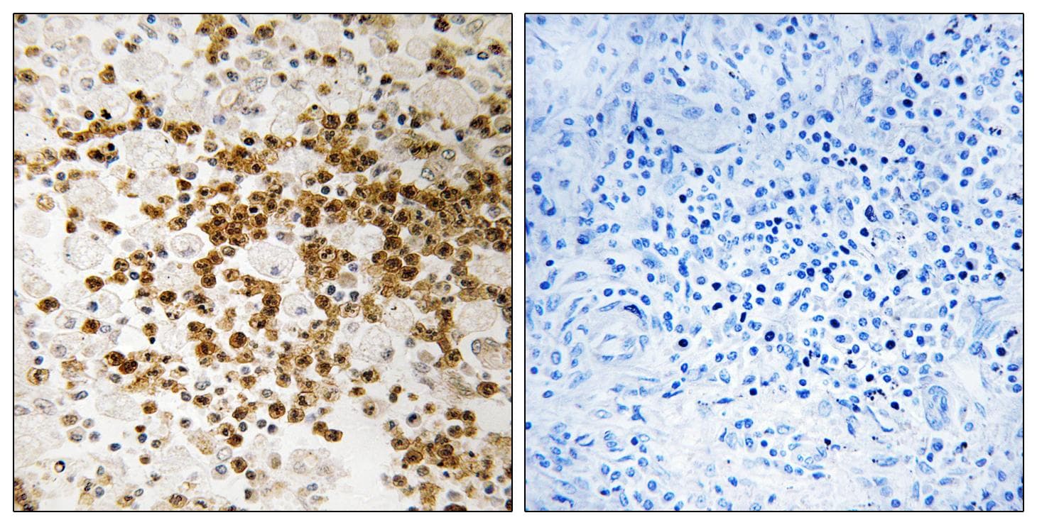 S100P Antibody