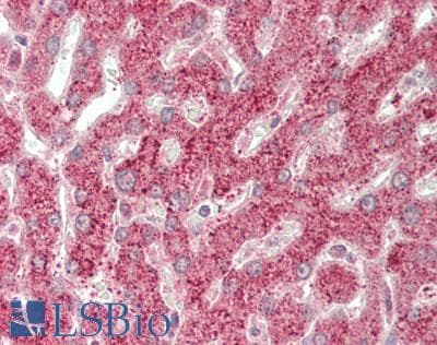 DDIT3 / CHOP Antibody (aa1-169)