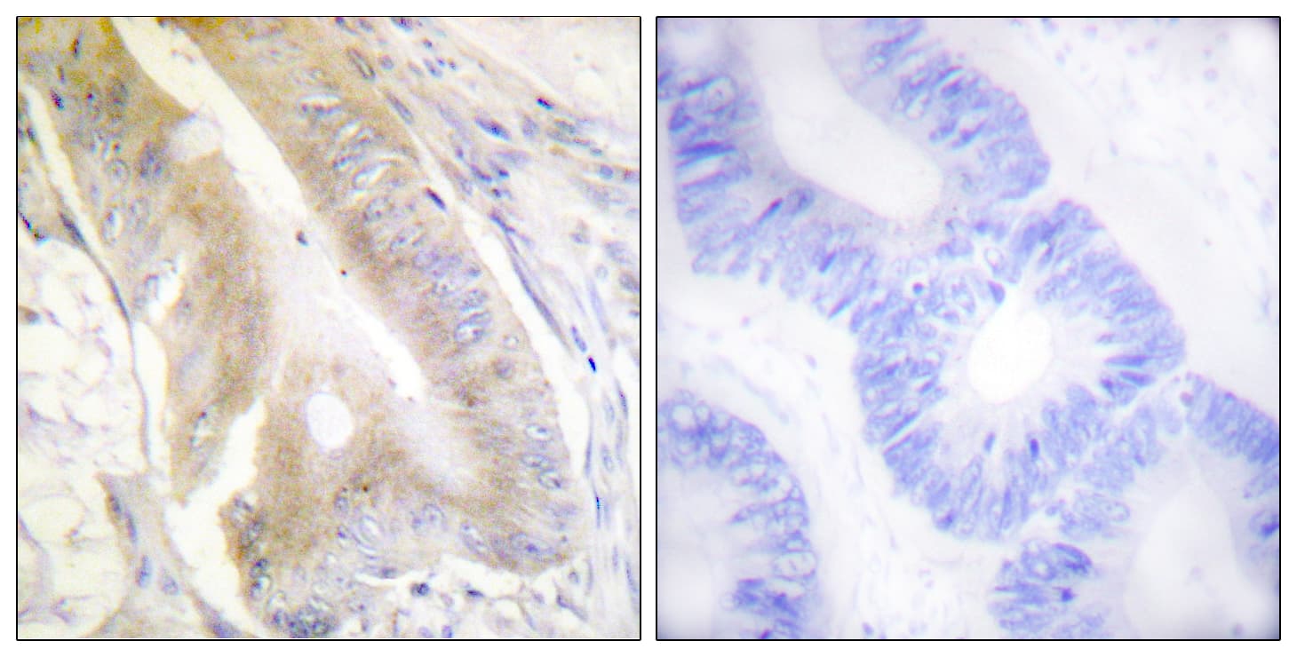 ACO1 / Aconitase Antibody (aa106-155)