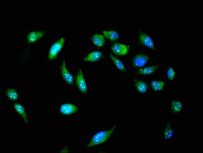 Polyclonal Rabbit anti-Human POLI Antibody (IHC, IF)
