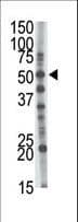 Polyclonal Rabbit anti-Human GCNT1 / C2GNT Antibody (aa88-117, IHC, WB)