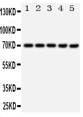 HSP70 / Heat Shock Protein 70 Antibody (aa577-596)