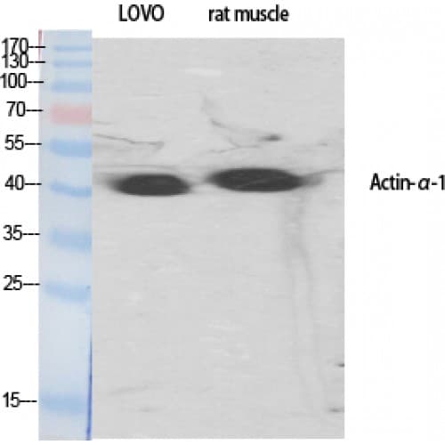 ACTA1 / Skeletal Muscle Actin Antibody (1-80 aa, N-terminal)
