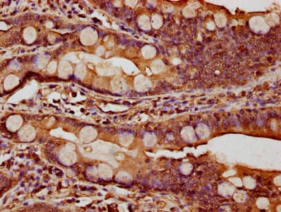Polyclonal Rabbit anti-Human CTNNA1 / Catenin Alpha-1 Antibody (WB)
