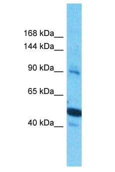 PCDHGB5 Antibody (aa221-270)