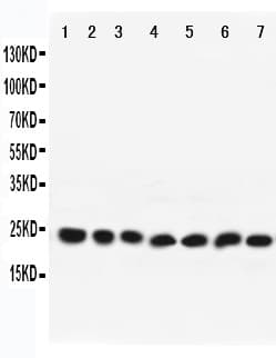 Polyclonal Rabbit anti-Human RAB9A / RAB9 Antibody (aa178-193, WB)