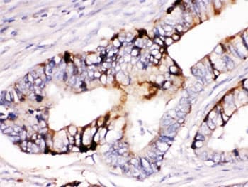 ZP2 Antibody