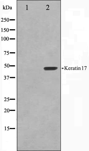 Polyclonal Rabbit anti-Human KRT17 / CK17 / Cytokeratin 17 Antibody (IHC, IF, WB)
