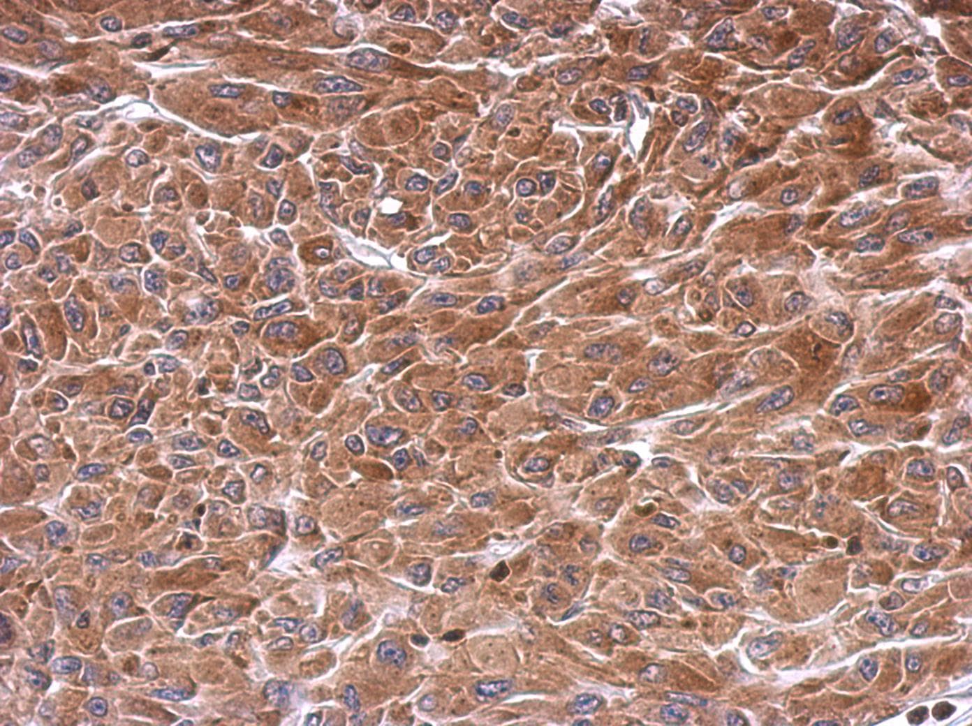 CAMKK2 Antibody (aa1-498)