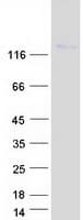 Human ITGAD / CD11d Protein (Recombinant Myc-DDK (Flag))