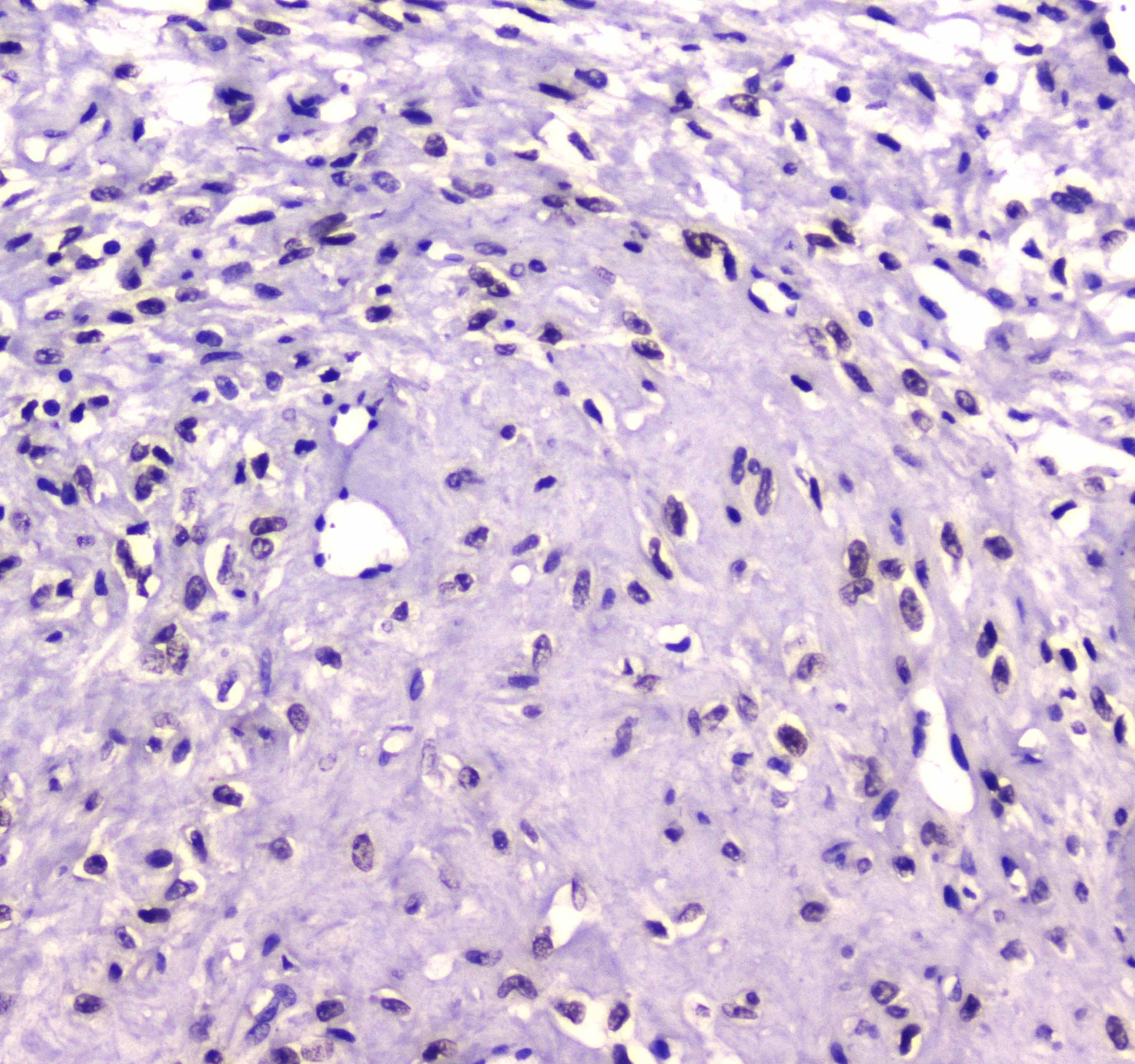 RUNX1T1 / ETO Antibody