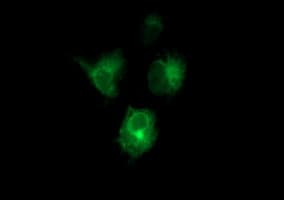 IHC-plus™ CD22 Antibody (clone 1B1)