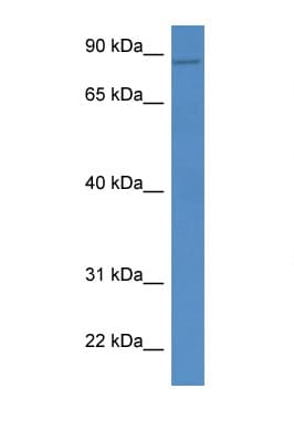 Polyclonal Rabbit anti-Human VAC14 / TRX Antibody (aa711-760, IHC, WB)