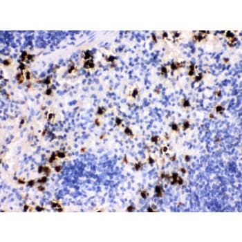 Polyclonal Rabbit anti-Mouse S100A8 / MRP8 Antibody (aa2-89, IHC, WB)