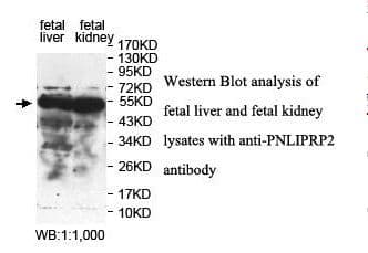 PNLIPRP2 Antibody (aa224-448)
