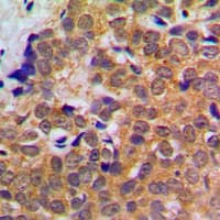 STAT5 A+B Antibody (C-Terminus)