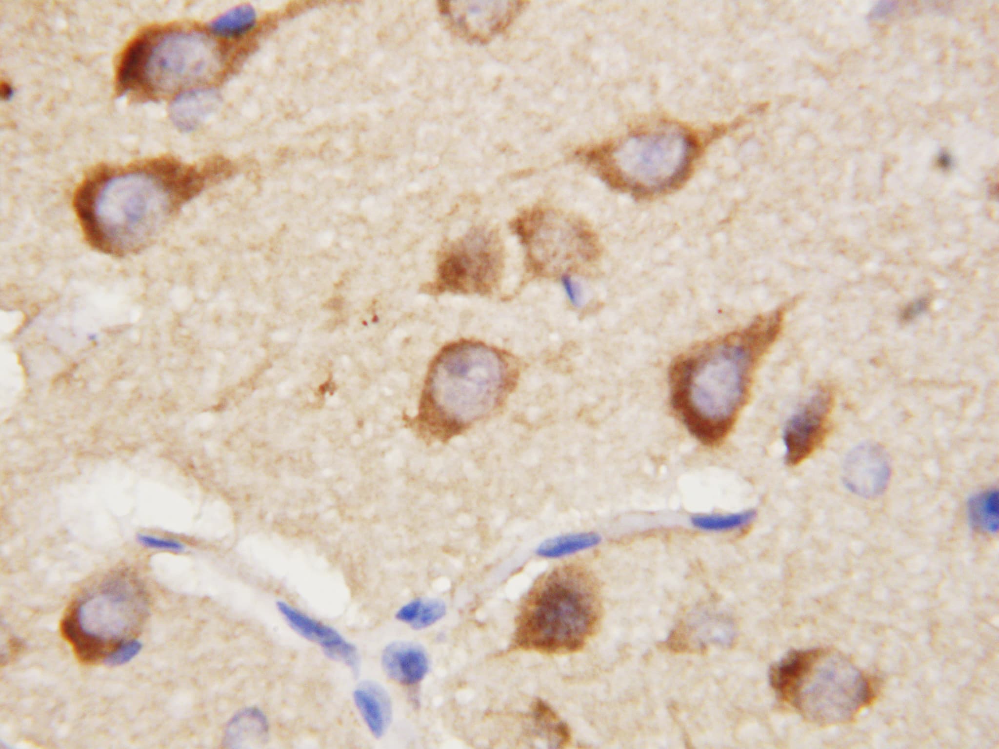 Polyclonal Rabbit anti-Human PPID / Cyclophilin D Antibody (aa351-370, IHC, WB)
