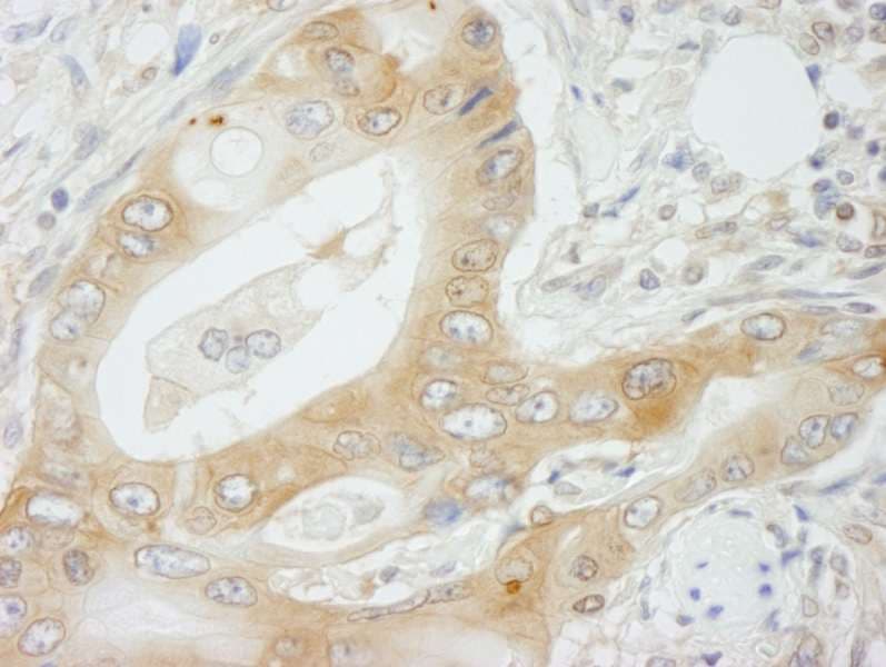 NMI Antibody (aa250-C-term)