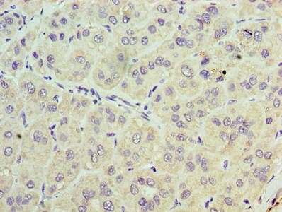 TRBC1 Antibody (aa1-177)