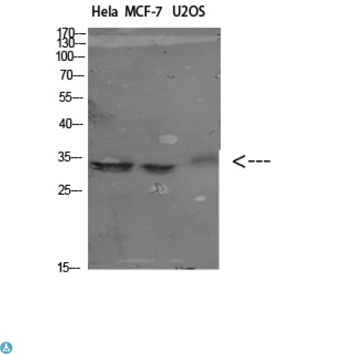 Polyclonal Rabbit anti-Human NANOS1 / NOS1 Antibody (WB)