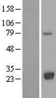 LYPLA2 Protein (Over-Expression Lysate Myc-DDK (Flag))