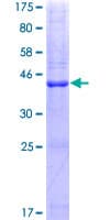 Human PLA2G10 Protein (Recombinant GST)