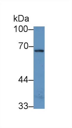 NADK / NAD Kinase Antibody (aa187-426)