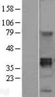 WNT8B / Wnt 8b Protein (Over-Expression Lysate Myc-DDK (Flag))