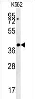 Polyclonal Rabbit anti-Human DGCR14 Antibody (aa217-244, WB)