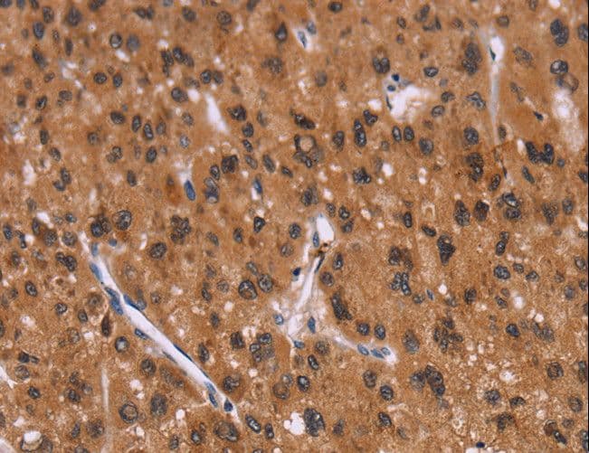 Polyclonal Rabbit anti-Human ID2 Antibody (IHC)